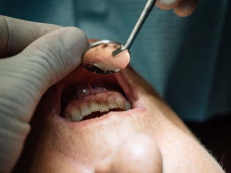 Dentist opens the mouth of his patient and begins to revise the interior helped by his instruments